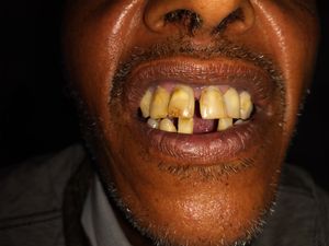 Saúde e Emergências - Tratamento dentário,cirurgia e prótese dentaria