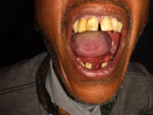 Vaquinha Online - Tratamento dentário,cirurgia e prótese dentaria