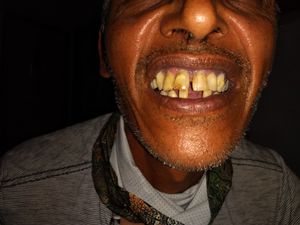 Cirurgia e prótese dentaria - Tratamento dentário,cirurgia e prótese dentaria