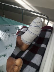 Vaquinha Online - prótese 