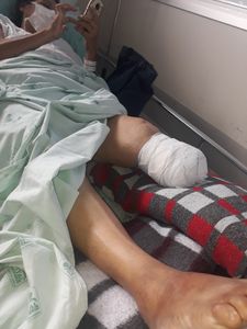 Terceira Idade - prótese 