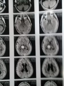 Vaquinha Online - AJUDA GABRIEL