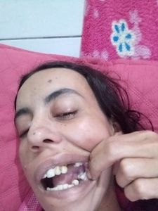 Vaquinha Online - Tratamento dentário