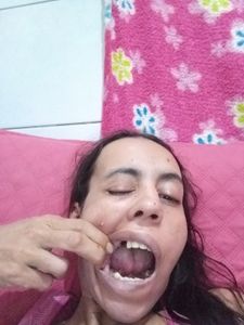 Causas e Comunidade - Tratamento dentário