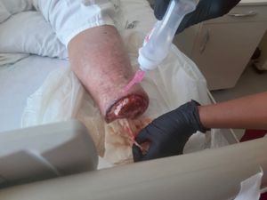 Saúde e Emergências - Me Ajudem a Voltar a Andar