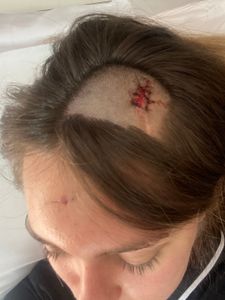 Ajude Bianca Helen Tiburcio Na Luta Contra o Tumor Cerebral imagem 6