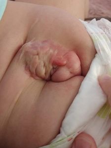 Saúde e Emergências - Lis Vitória - Cirugia para uma vida melhor! 