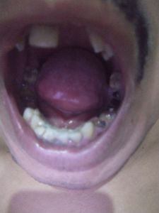 Vaquinha Online - Me ajude a sorrir e ser feliz.