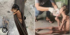 Caridade e Filantropia - Ajude as crianças do povo Yanomami. Já morreram 570 crianças de desnutrição e fome pela contaminação por mercúrio.  