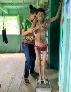 Vaquinha Online - Ajude as crianças do povo Yanomami. Já morreram 570 crianças de desnutrição e fome pela contaminação por mercúrio.  