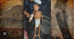 570 crianças MORRERAM de desnutrição, fome e pela contaminação por mercúrio, - Ajude as crianças do povo Yanomami. Já morreram 570 crianças de desnutrição e fome pela contaminação por mercúrio.  
