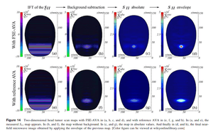 Aparelhos de Detecção de Câncer Cerebral - Aparelhos de Detecção de Câncer Cerebral