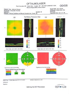 Cirurgia para não perder a visão  imagem 8