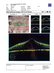 Cirurgia para não perder a visão  imagem 6
