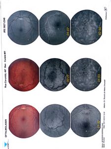 Cirurgia para não perder a visão  imagem 7