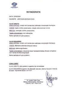 Vilhena/RO - Cirurgia para não perder a visão 