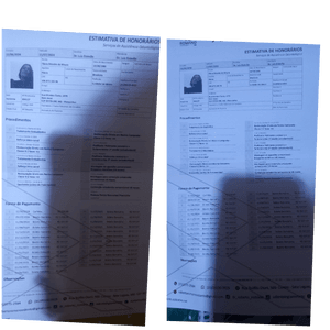 Vaquinha Online - Preciso arrumar meus dentes com urgência  bruxismo  periondentite 