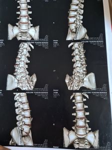 Vaquinha Online - Operação hérnia de disco 