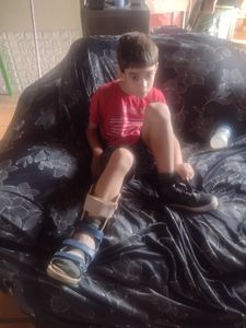 Cirurgia alongamento do tendão de Aquiles 