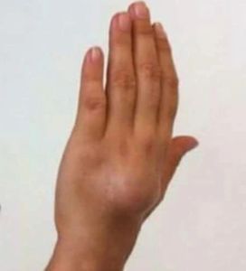 Ajude Paula - Cancêr raro. imagem 6