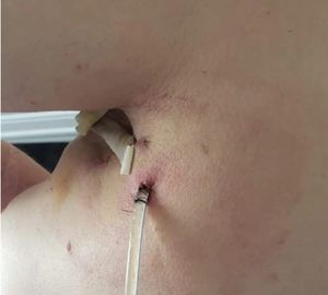 Ajude Paula - Cancêr raro. imagem 8