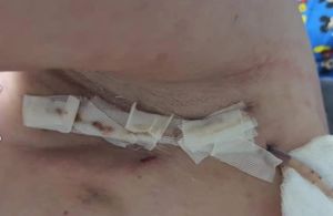 Ajude Paula - Cancêr raro.