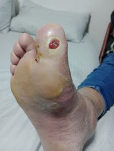 Vaquinha Online - PRÓTESE PARA O TAXISTA MANCUSO