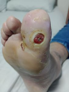 Saúde e Emergências - PRÓTESE PARA O TAXISTA MANCUSO