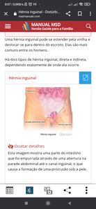 Ághata Eloíze  - Arrecadação para cirurgia de hérnia inguinal 