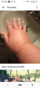 Vaquinha Online - SEQÜELA DE CÂNCER