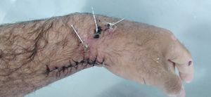 Me ajudem por comida na mesa , me recuperar e conseguir voltar a trabalhar  imagem 9