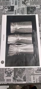 Me ajudem por comida na mesa , me recuperar e conseguir voltar a trabalhar  imagem 8