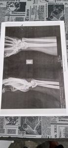 Me ajudem por comida na mesa , me recuperar e conseguir voltar a trabalhar  imagem 7