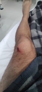 Saúde e Emergências - Me ajudem por comida na mesa , me recuperar e conseguir voltar a trabalhar 