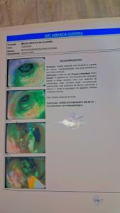 Nova Iguaçu/RJ - Unidos pela Meg