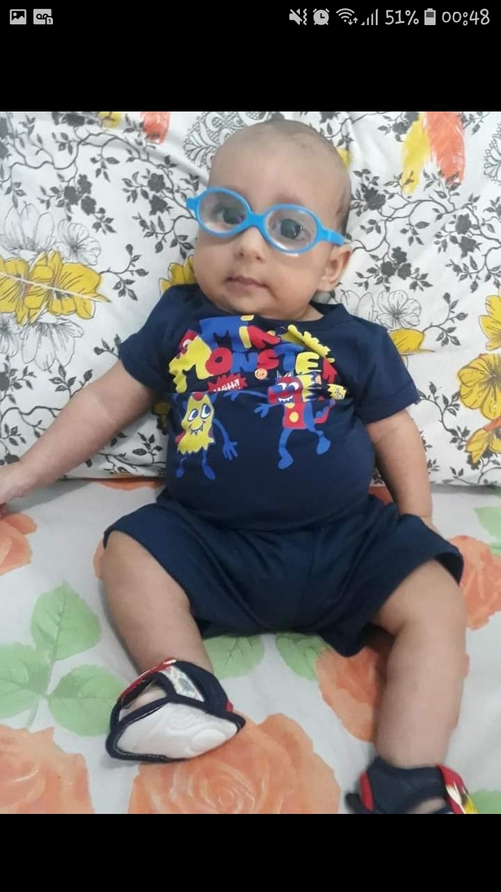 Saúde e Emergências - Ajude o bebê Nicolas  com síndrome rara