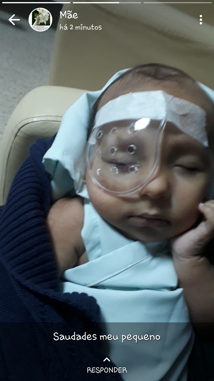 Porto Velho/RO - Ajude o bebê Nicolas  com síndrome rara