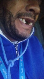 Vaquinha Online - Tratamento de implante dentário