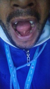 Saúde e Emergências - Tratamento de implante dentário