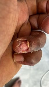 Lucas Figueiredo - Campanha do bem