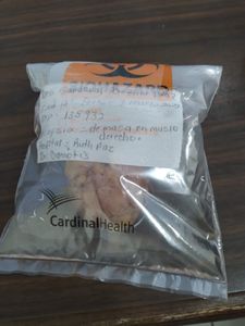 Vaquinha Online - Ajude meu irmão Davi a combater o câncer!