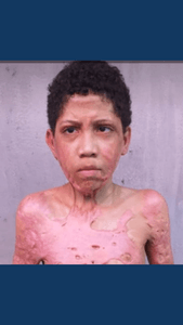 AMASQ - CNPJ: 37.977.252/0001-85 - Ajude sobreviventes de queimaduras