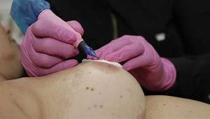 Programa Cuide de Você – Estética Avançada imagem 9