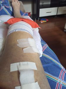 Vaquinha Online - Doação para Regina Greinert  - Puxadinho Gourmet