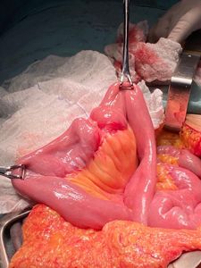 Campanha para custeio do tratamento do meu câncer  imagem 10