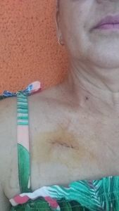 Campanha para custeio do tratamento do meu câncer  imagem 9