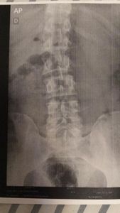 Vaquinha Online - Doação para Fisioterapia