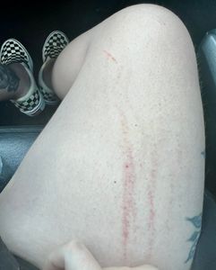 Piracicaba/SP - Por favor me ajudem a sobreviver…