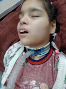 Tratamento Trigêmeas Especiais imagem 8