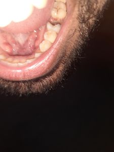 Vaquinha Online - Tratamento Dentário